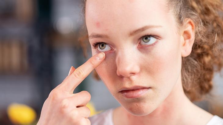 Mevsimsel değişim cildinizi tehdit etmesin! Uzmanlardan bahar uyarısı