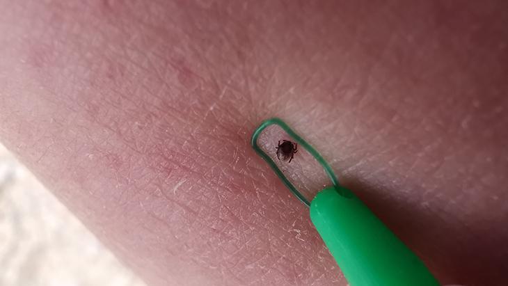 Halsizlik ve ateşi geçiştirmeyin! Keneye karşı uzmanlar uyardı: 'Ciddiye alın'