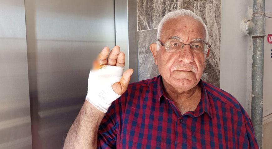 Asansörde korkunç saldırı! Komşusu parmağını ısırarak kopardı: Onu çok severdim, niçin yaptı anlamadım