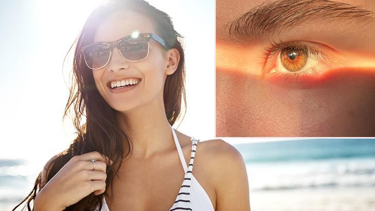 Gözünüz de güneş yanığı olabilir! Fotokeratit tehlikesine dikkat: Gözlükte bu özellik şart