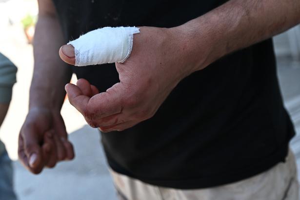 Acemi kasaplar hastanelere koştu Bu bayram da manzara değişmedi