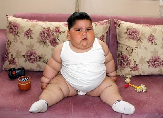 5 yaşında 90 kiloydu 6 yıl sonra görüntülenen Yağız şaşırttı