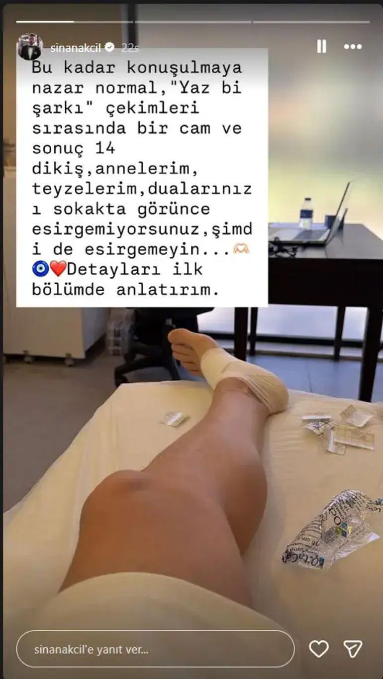Sinan Akçıl ayağındaki 14 dikişle sahneye çıktı