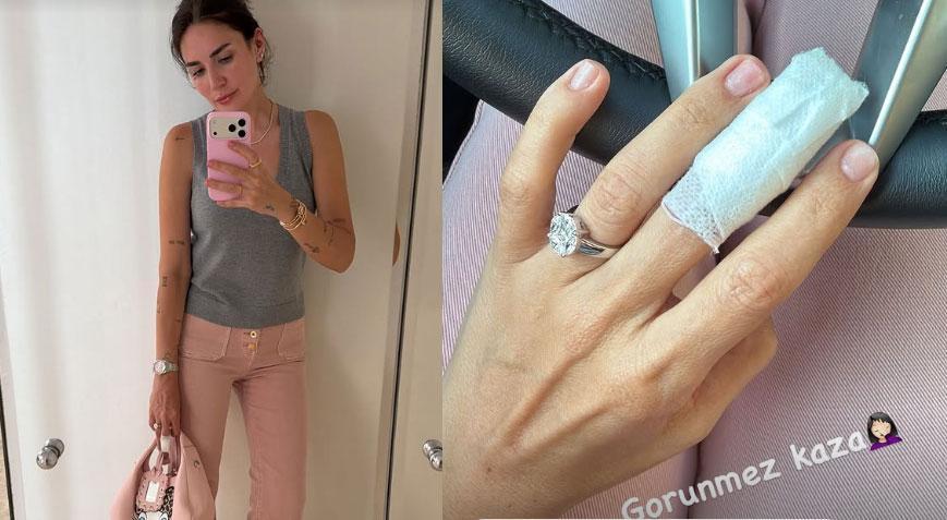 Buse Varol’dan ‘görünmez kaza’ paylaşımı Parmağı sargıya alındı
