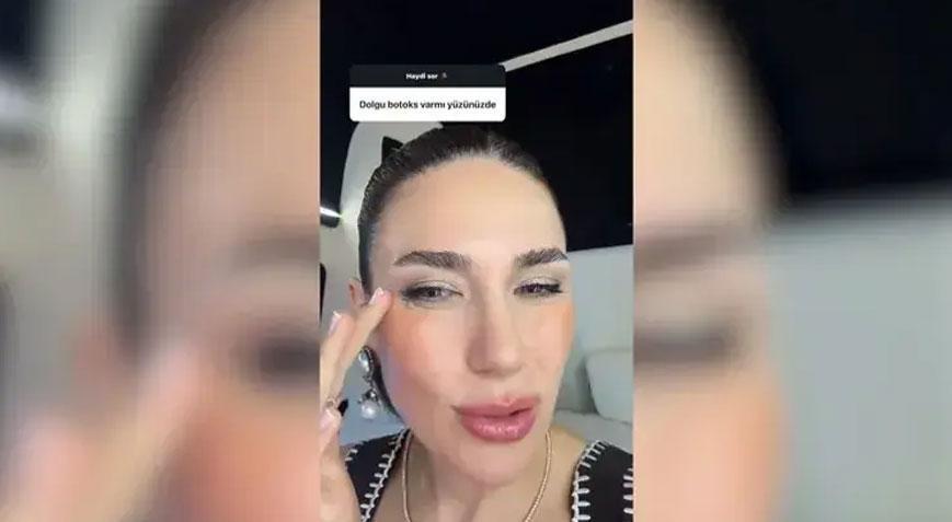 Buse Varol’dan ‘görünmez kaza’ paylaşımı Parmağı sargıya alındı