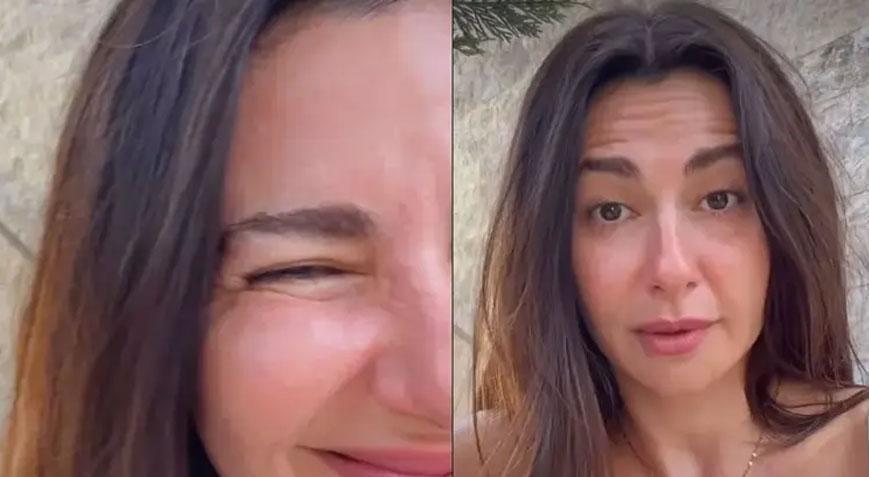 SİZ HAYATINIZDA HİÇ BÖYLE BOTOKS GÖRDÜNÜZ MÜ