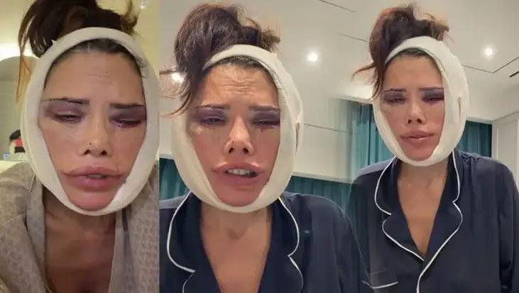 Korede yüz nakli olmuştu Survivor Didem Cerandan kölelik çıkışı