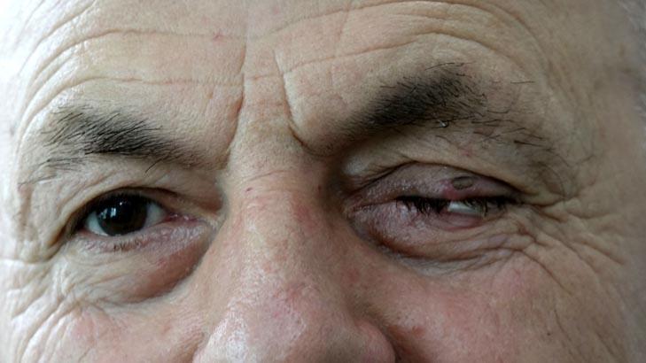 Gözlükten kurtulmak istedi, güzünü kaybedip çıktı Hastaneden dikkat çeken videolu yanıt