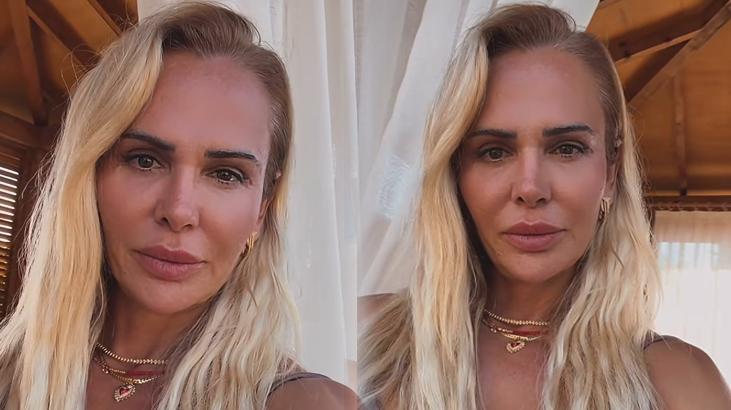 Estetiğe servet ödemişti Survivor Nagihan Karadere son haliyle dikkat çekti