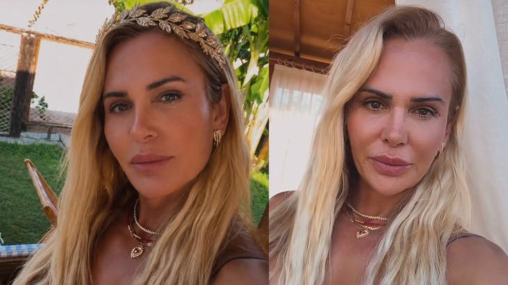 Estetiğe servet ödemişti Survivor Nagihan Karadere son haliyle dikkat çekti