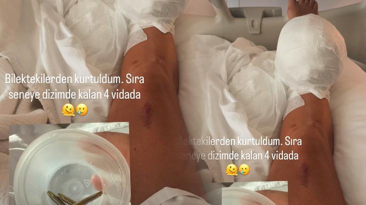 Hastane paylaşımı sevenlerini korkuttu Yasemin Yürük sağlık durumunu açıkladı