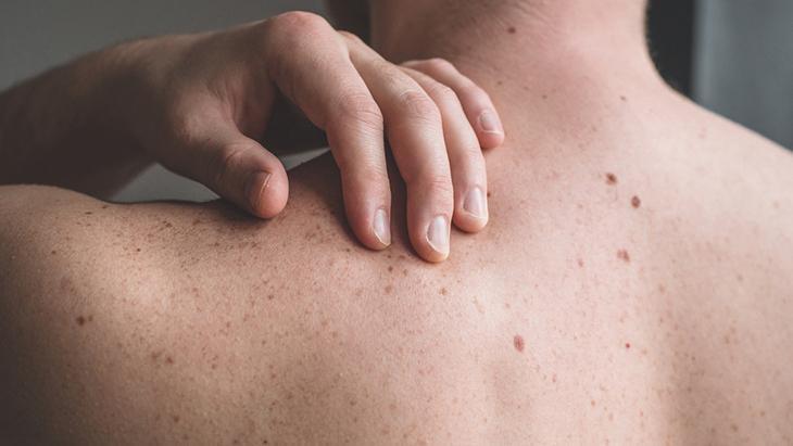 Benin kısa sürede hızlıca büyümesi tehlikeli olabilir