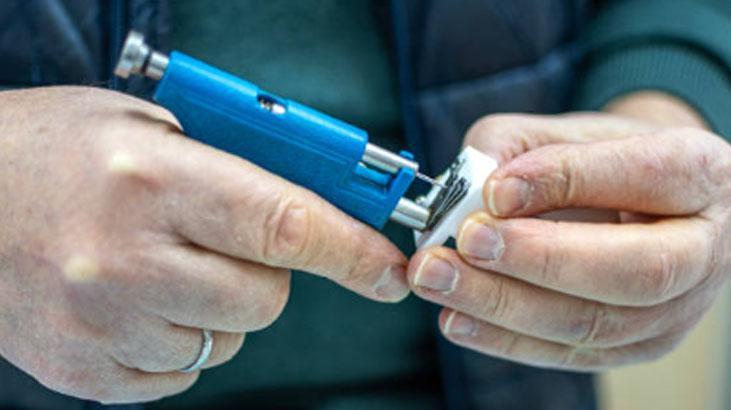 Kulağı 20 yıl önce yeşile döndü Röntgen sonucu şaşırtıcı: İçeride kalmış