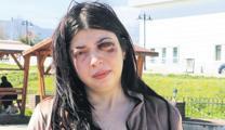 Tacizin bıraktığı yara: Platinler