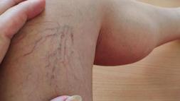 Son yıllarda hızla yaygınlaşıyor! Bu hatalar varise davetiye çıkarıyor