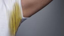 Kol altındaki sarı lekeler anında yok oluyor! Sırrı etiketinde saklı