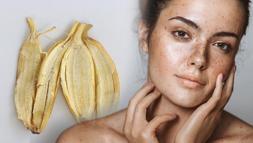 Doğum ve güneş lekelerine birebir! Sadece bir muz kabuğu yeterli
