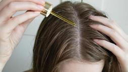 Saç derisini canlandıran serum! Sürdükçe kepeği hedef alıyor, masrafsız çözüm