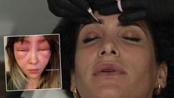 Kaşlarını bu teknikle boyattı, yüzü davul gibi şişti! 'Kendimi tanıyamadım'