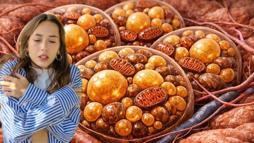 Kat kat giyiyoruz ama nafile! Vücudun gizli kaloriferi buymuş