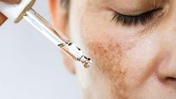 Her cilt sorununa aynı anda etki eden içerik: Azelaik asit! ‘Çok yönlü çalışıyor'