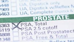 Erkeklerde PSA testi ne işe yarıyor? - PSA testi neden yapılır?
