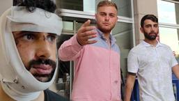 Yol verme kavgası yüzünden çenesini kırmışlardı! Duruşmada özür dilediler