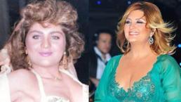 Ünlülerin estetiksiz halleri