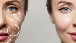 Geç başlanan estetik uygulamalarda başarı elde etmek mümkün mü? 