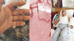 Elini ısıran yılanı poşete koyup hastaneye götürdü! "Bu karar hayatımı kurtardı"