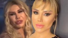 Ceylan yüzündeki değişimle dikkat çekti