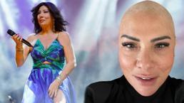 Saç kıran hastalığına yakalanmıştı! Işın Karaca peruksuz halini paylaştı