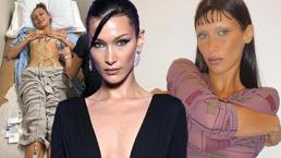 Tedavi sürecini paylaşan Bella Hadid'den 'uyuşturucu' açıklaması