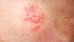 En büyük sebebi stres, sizi uykudayken yakalıyor! İşte zonanın bilinmeyen yüzü