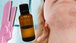 Sakın ustura değdirmeyin! Çene tüylerini kökünden kurutan 2 doğal çözüm