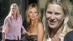 Kate Moss'un görüntüsü şaşırttı! 'Kötü alışkanlıkların kurbanı'