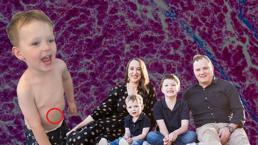 Kreşten geldiğinde ateşi vardı, şişliği görmedi! Acı gerçek hastanede anlaşıldı