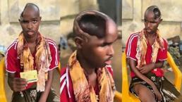 'Beyni olmayan adam' gerçek mi? 'Gizli yetenekleri ortaya çıkabilir'