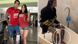 175 bin dolar ve dayanması zor bir ameliyat! Hepsi 7 cm daha uzun olabilmek için