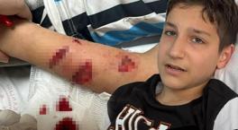 Rize'de dehşet! 12 yaşındaki çocuk, sevdiği köpeğin saldırısına uğradı