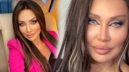 Sayısız estetik yaptıran Umut Akyürek son hali!