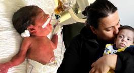 Bedir bebeğin ölüm ve yaşam arasındaki savaşı! 8 ay sonra haber geldi