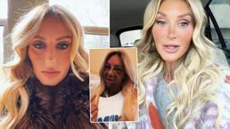 Diş tedavisi bu hale getirdi! 'Canavar gibi hissediyorum' diyerek paylaştı, sosyal medyayı sarstı