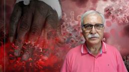 Yeni pandemi maymun çiçeği virüsü mü? Prof. Dr. Tevfik Özlü'den net cevap