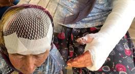 Keçileri otlatmaya giden kadın dehşeti yaşadı! Kanlar içinde kaldı