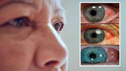 Basit bir apse sandı, gözünden oldu! Her gün daha da büyüyor: 'Rengine aldanmayın'