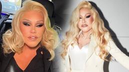 'Hiç estetik yaptırmadım' demişti! 'Kedi Kadın'dan acı haber geldi