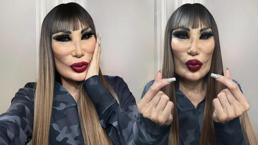 Lyn May değişimiyle bambaşka biri oldu! Yüzüne yaptırdığı işlemler şoke etti