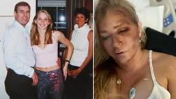 Prensi cinsel istismarla suçlayan Epstein kurbanı kaza geçirdi! '4 gün ömrüm kaldı'
