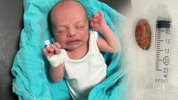 El niño de 4 años dio azúcar de almendras a su hermano de 16 días, luego increíble